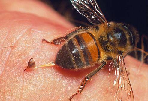 Первая помощь при укусе ребенка пчелой