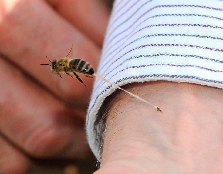 Укус пчелы: польза или вред, симптомы, лечение, народные средства