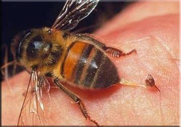 Правила первой помощи при укусе пчелы